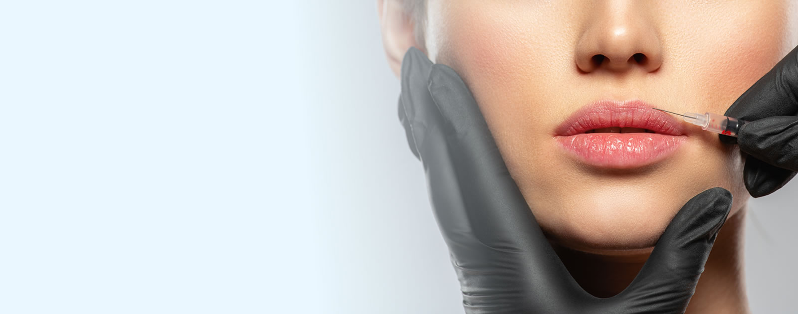 Dermal fillers